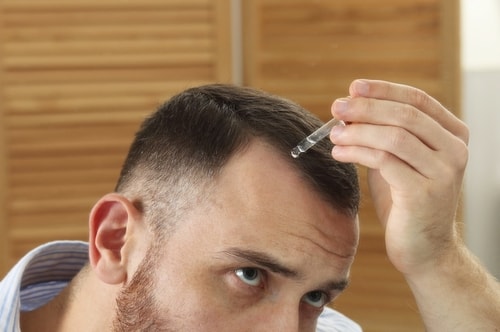 Vitamin deficiency & hair loss