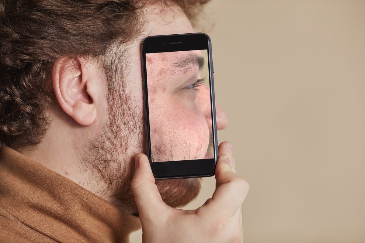 Acne and the online doctor